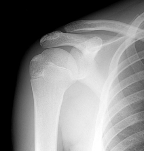 Titlu articol cu spotify